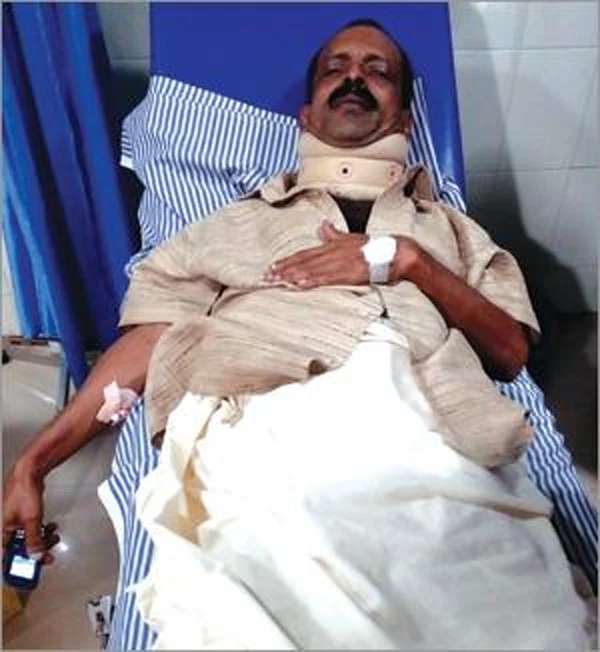 Police attacks Kerala Kaumudi reporter at his home, Thiruvananthapuram, News, Police, Crime, Case, Complaint, hospital, Treatment, Kerala