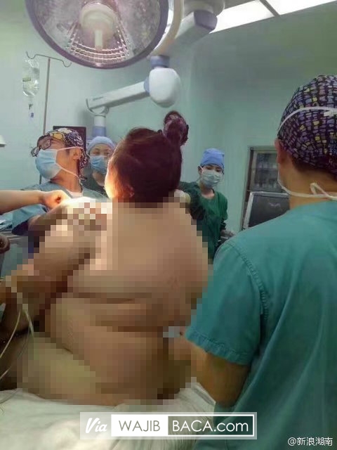 Astaga!, Dibutuhkan 16 Dokter Untuk Bantu Wanita Ini Melahirkan Karena Wanita Ini Memiliki... Astaga!, Dibutuhkan 16 Dokter Untuk Bantu Wanita Ini Melahirkan Karena Wanita Ini Memiliki...
