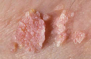 Image APA NAMA OBAT DAGING TUMBUH TERBUKTI MANJUR DIAPOTIK SEKITAR
