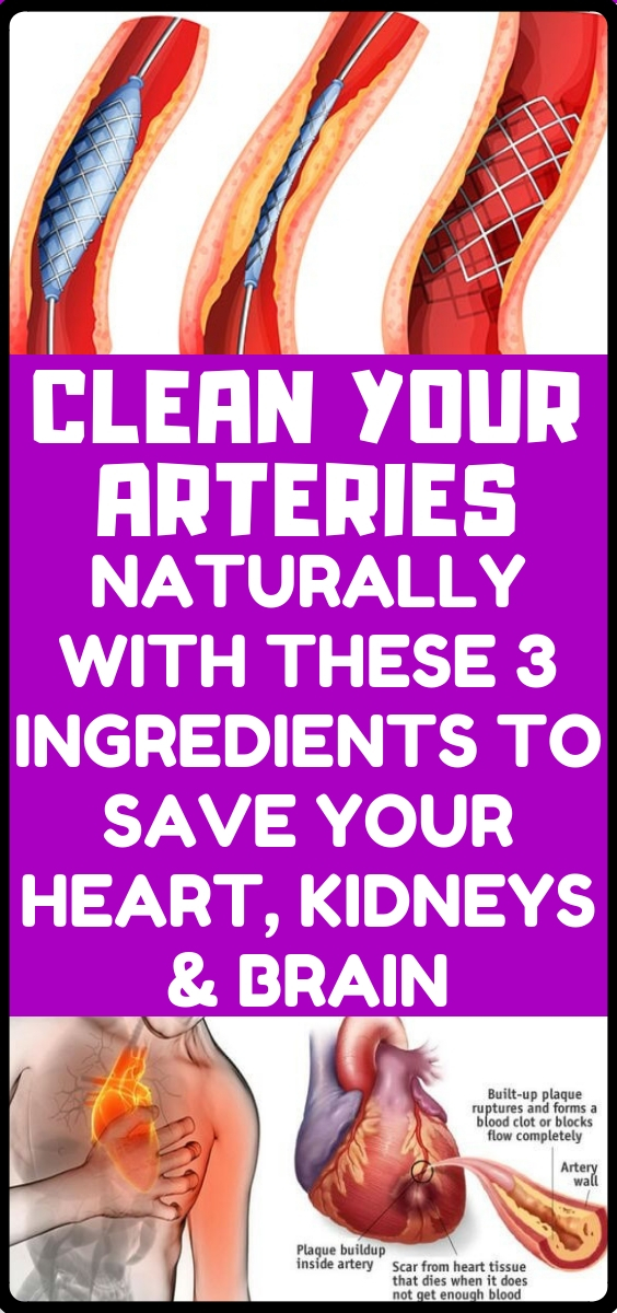 how-to-clean-out-plaque-in-arteries-3-ingredients-mixture-skiniez