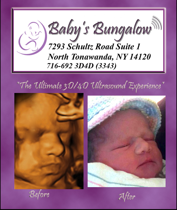 Baby's Bungalow 3D Ultrasound Buffalo 4D Ultrasound