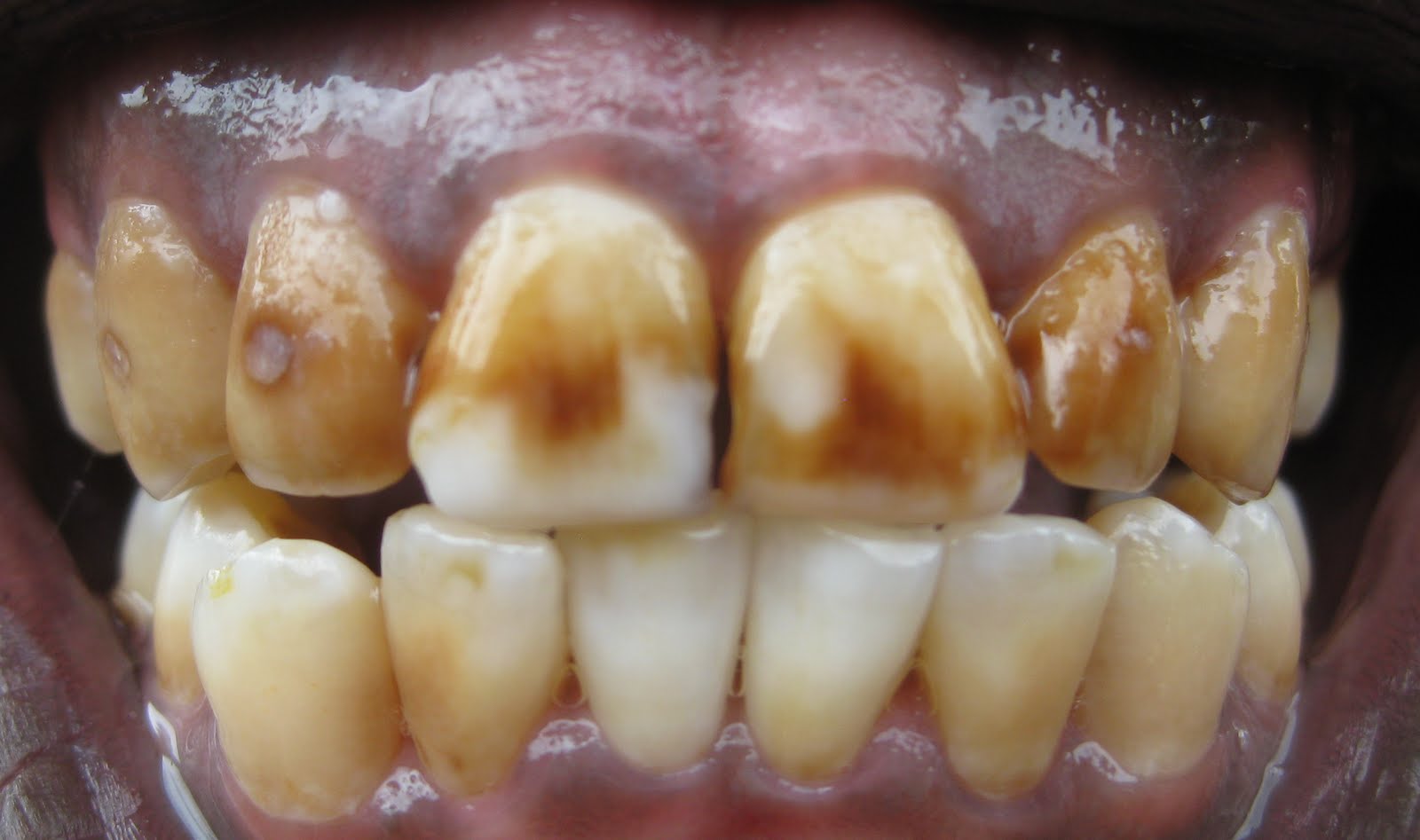 Word and Deed The Year of Dental Disasters