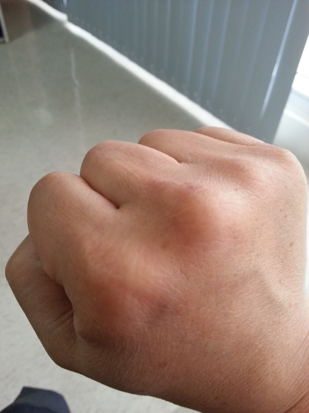 Kung Fu Fever My Fist is swollen Again