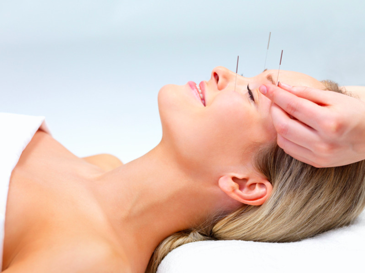 Acupuncture In Boca Raton