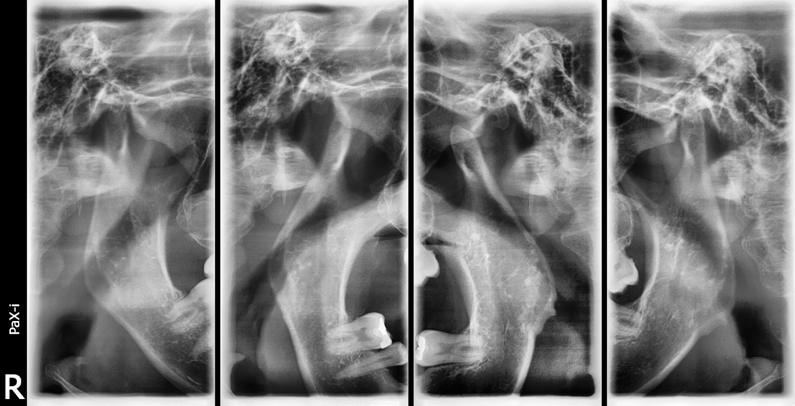 Advantages of Digital Radiology: Advantages of Digital Radiology