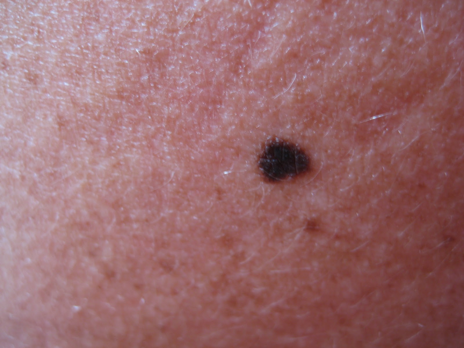 A bőrön található foltok és pigment problémák kezelése