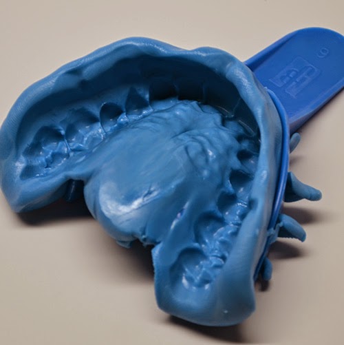 When Tara Met Blog Review SmileBrilliant Teeth Whitening System