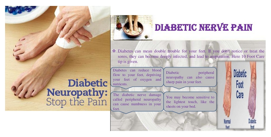 Diabetic Nerve Pain Medications