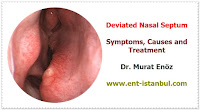 Deviated Nasal Septum - Symptoms of Nasal Septum Deviation - Computer Tomography Imaging Before The Septoplasty Operation - Technique of Septoplasty Operation - Caudal Septoplasty and  External Strut Graft Technique - Septoplasty Operation in Istanbul - Septoplasty Operation in Turkey - Septum Deviation Correction Surgery in Istanbul