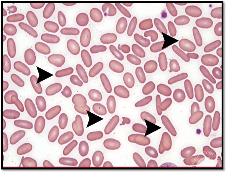 Atlas de Hematologia