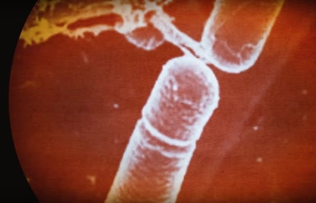 للتقضاء على الشيخوخة حقنت نفسها ببكتيريا عمرها 3.5 مليون عام 