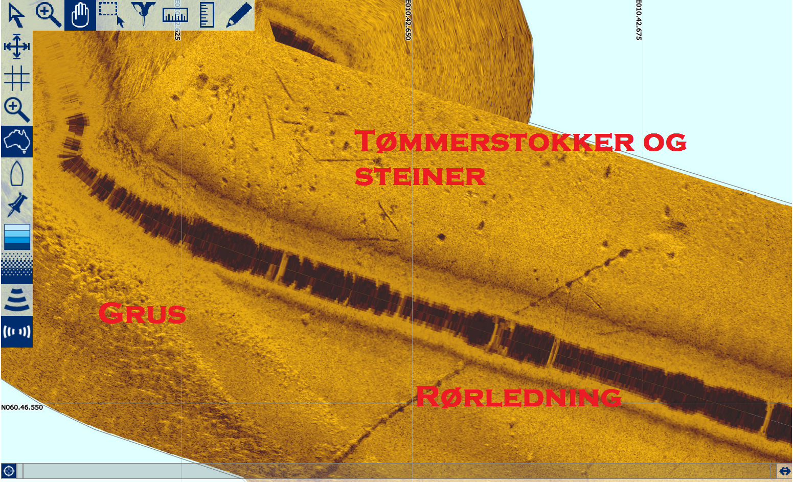 Totalscan HDI LSS 3D What?