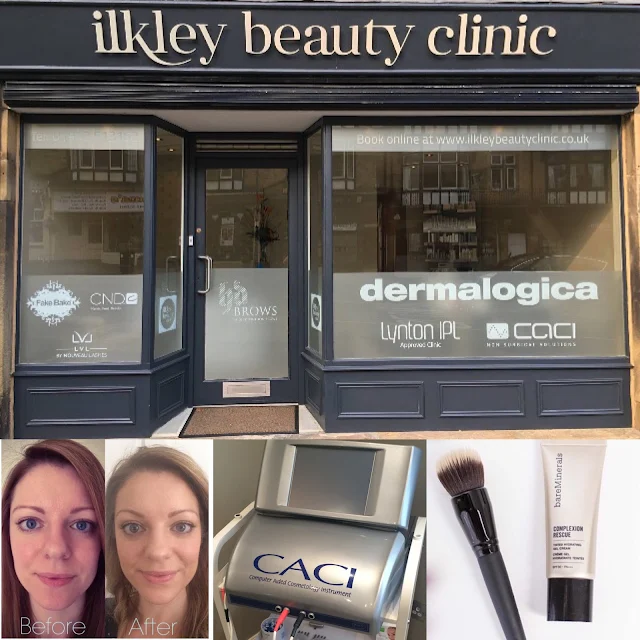 ilkley beauty clinic, caci facial, bare minerals, complexion rescue, review, before and after caci
