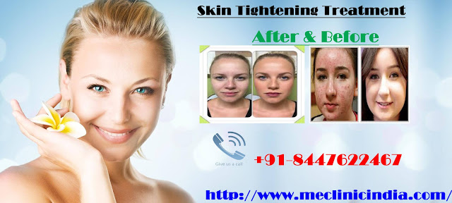 skin tightening treatment delhi