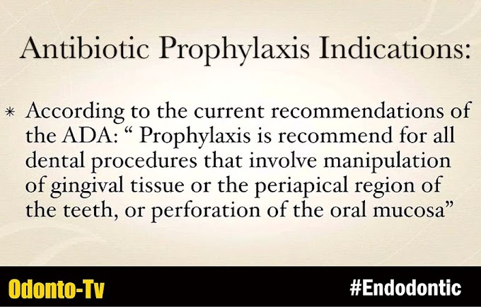 INTERVIEW: Antibiotic Prophylaxis for the Endodontic Patient - Dr. David Abdelmalak