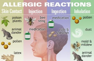 Allergie d'inverno: come riconoscerle e prevenirle