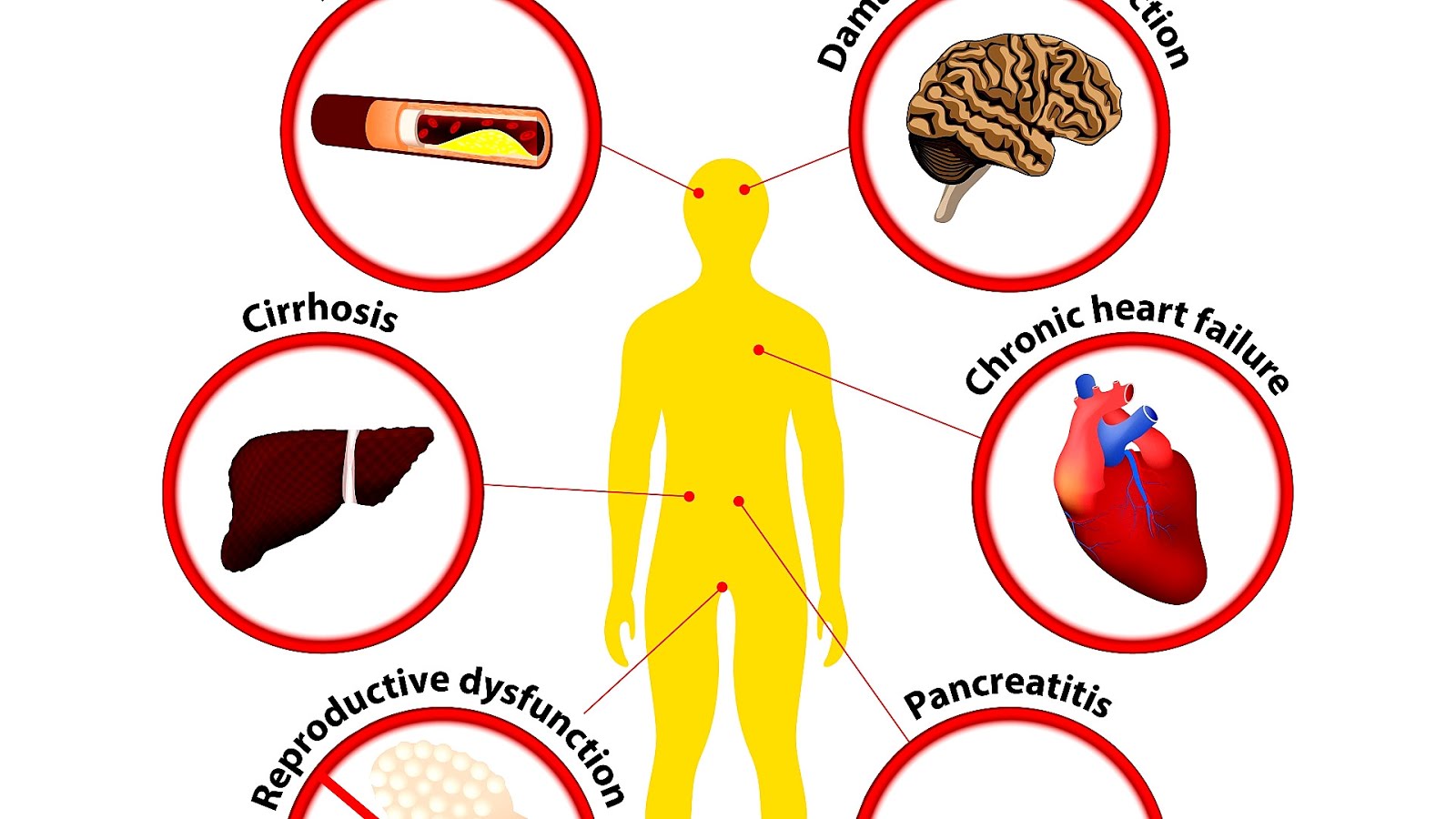 Effects Of Alcohol On Pancreas Effect Choices