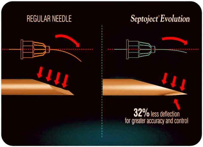 DENTAL MATERIALS: Septoject Evolution Needles - Septodont