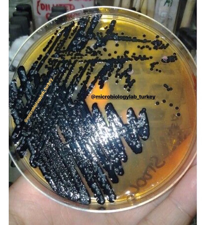 SALMONELLA SPP. Microbiology Laboratory Turkey