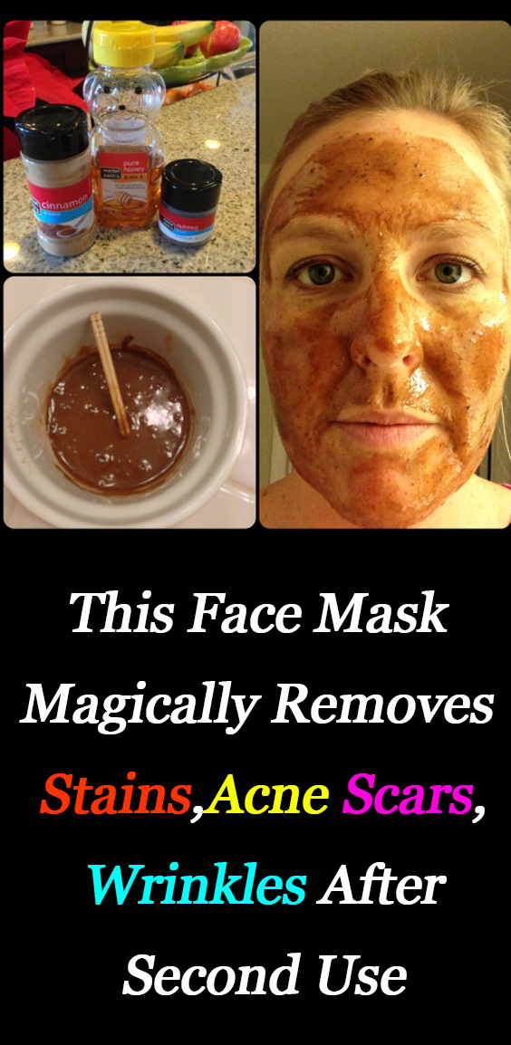 This Face Mask Magically Removes Stains , Acne Scars and Wrinkles After Second Use Healthy