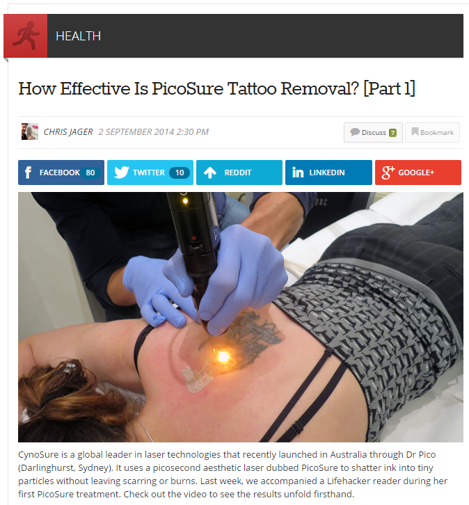 picosure laser tattoo removal picosure laser tattoo removal