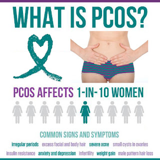 1 dari 10 wanita menderita PCOS 1 dari 10 wanita menderita PCOS