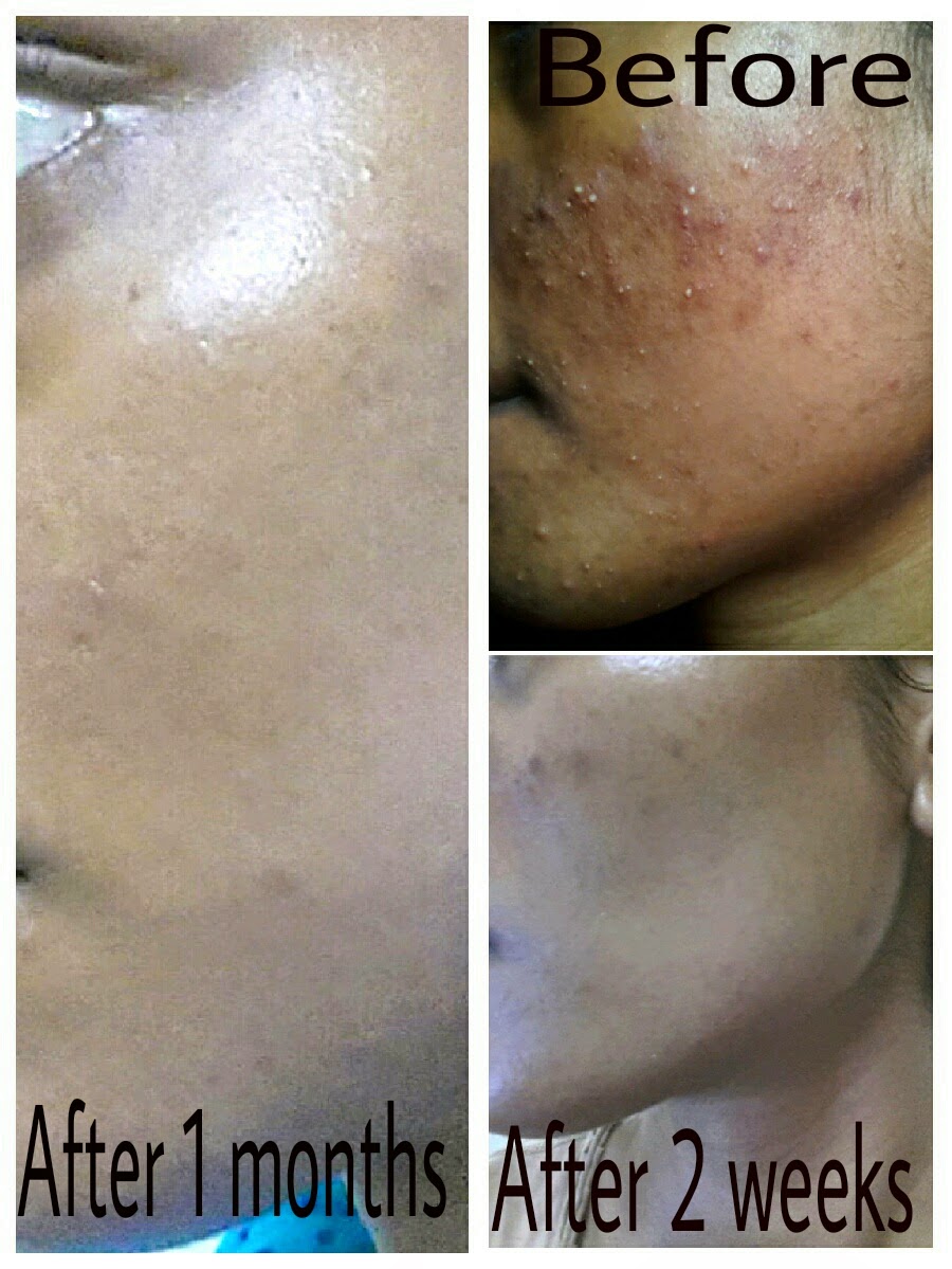 Makeup Artist's Choice Before/After Pics and Testimonials