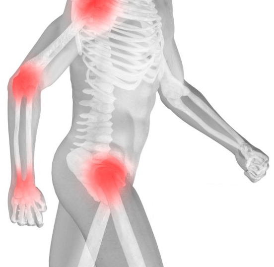 6 τροφές που προκαλούν φλεγμονές στο σώμα