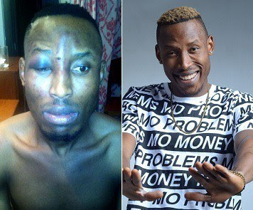 Exclusive: Burnaboy invited by the police in connection with Mr 2Kay