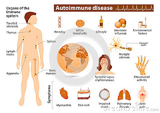 Treatment for psoriasis autoimmune disease chronic autoimmune