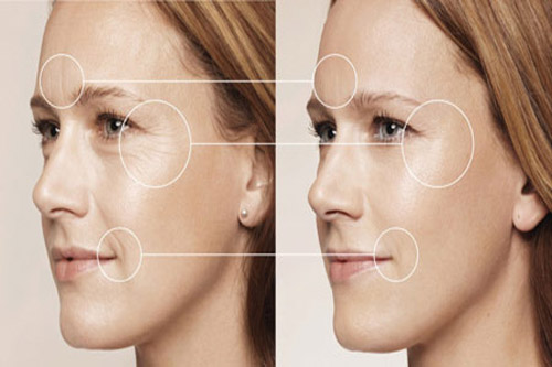 Collagen Gold Adiva giúp làn da chảy xệ đẹp hơn