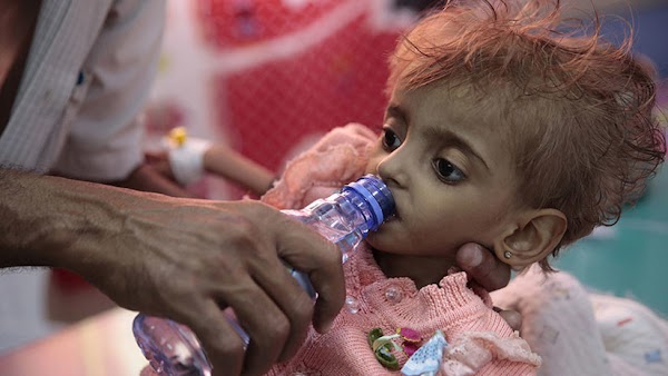 ( VIDEO ) la hambruna amenaza a yemen . ( VIDEO ) la hambruna amenaza a yemen .