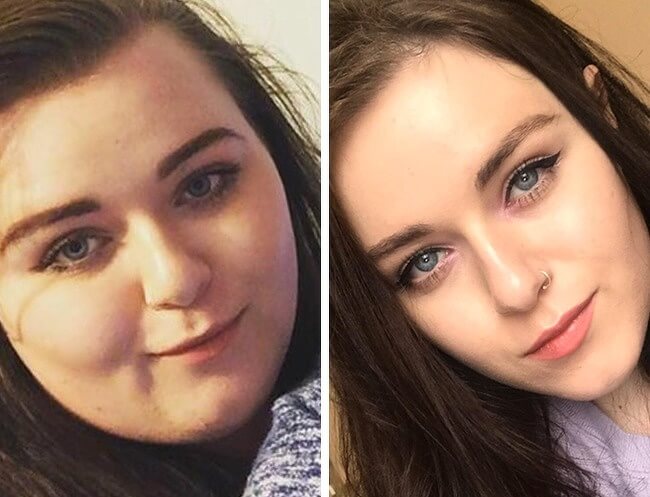 21 Before And After Photos Of People Who Managed To Lose Weight and Begin A Brand New Life - After 15 months of hard work, she managed to lost 150lb.