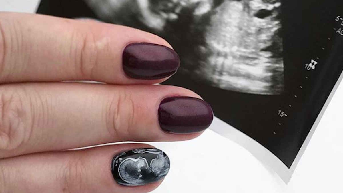 Pregnant Women Have Their Nails Painted With Their Ultrasound Pictures, And It's Amazing