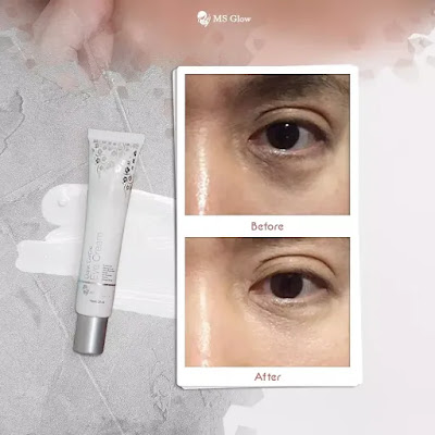 ms glow dark circle eye cream