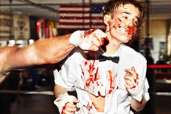 tony kelly fotografia fashion justin bieber ensanguentado luta porrada briga