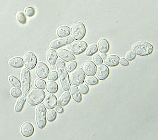 Yeast under Bright field microscope