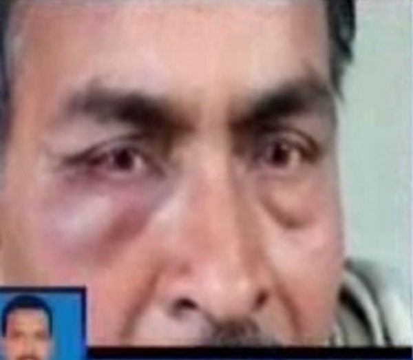 জায়গা না ছাড়ায় চলন্ত ট্রেনেই সহযাত্রীকে বেদম মার, পলাতক অভিযুক্ত