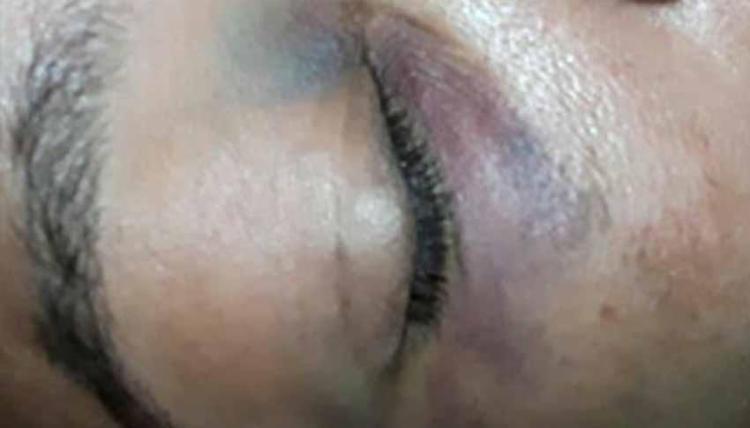 Cobradora de ônibus é agredida com soco por ambulante em Salvador