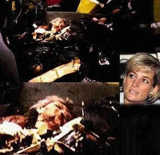 Autopsy Pictures Of Princess Diana princess diana death photos chi^@#