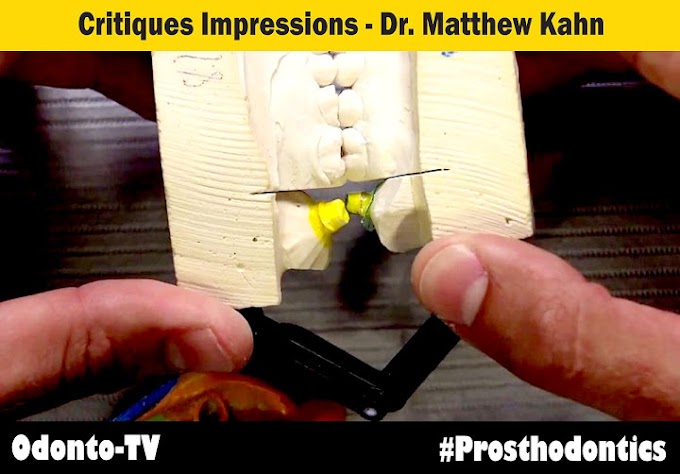 DENTAL IMPRESSION: Critiques Impressions - Dr. Matthew Kahn