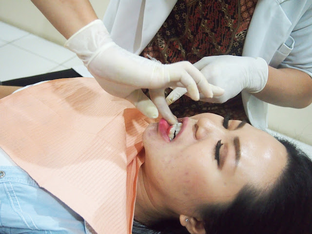 Teeth scaling and whitening for a perfect teeth. The Clinic Tanjung Duren for beauty and dental treatment.