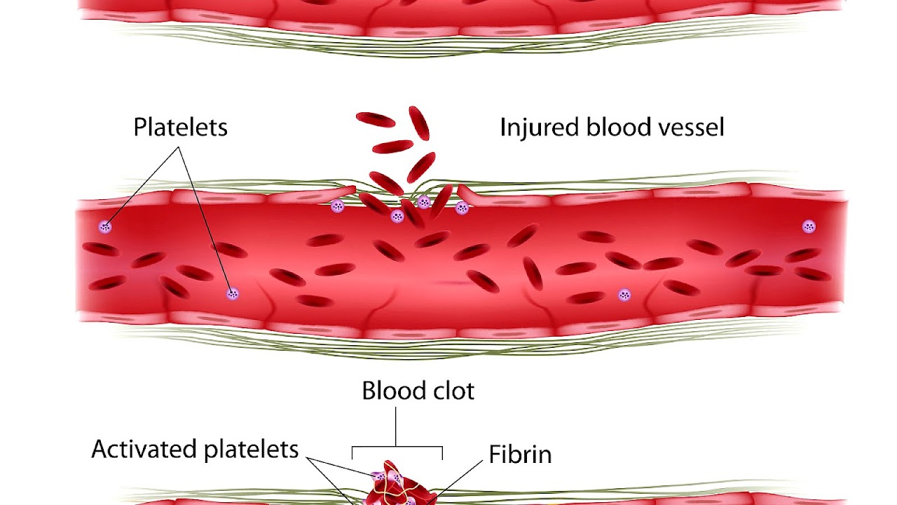 Hemostasis Blood Vessel Injury Injury Choices