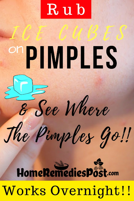 Ice Cubes For Pimples, How To Use Ice For Pimples, Ice For Acne, How To Get Rid Of Pimples, Home Remedies For Pimples, Pimples Home Remedies, Get Rid Of Pimples Overnight Fast, Pimples Treatment, How To Treat Pimples, How To Cure Pimples, Pimples Remedies, Remedies For Pimples, Cure Pimples, Treatment For Pimples, Best Pimples Treatment, Pimples Relief, How To Get Relief From Pimples, Relief From Pimples, How To Get Rid Of Pimples Fast,