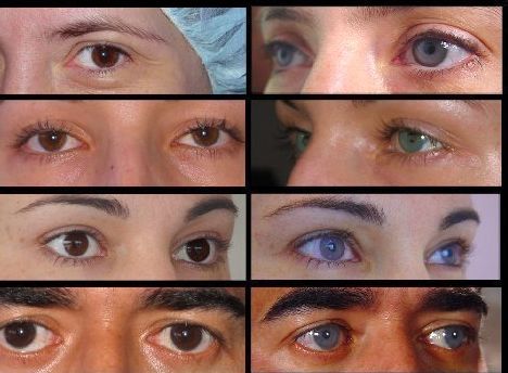 Eye Colors: How to Permanently Change Eye Color