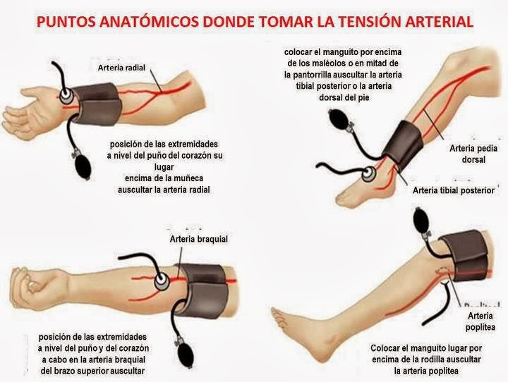 Aprender todo acerca de hipertensión pulmonar precapilar