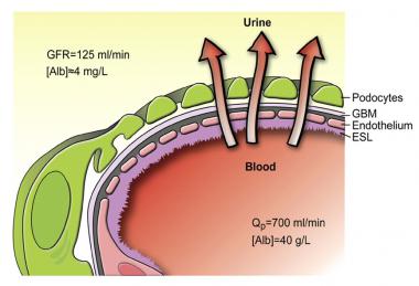 Sindrom Penapis Buah Pinggang Bocor Atau Nephrotic Syndrome Punca Dan Rawatannya