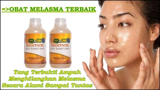 Obat Melasma Terbaik