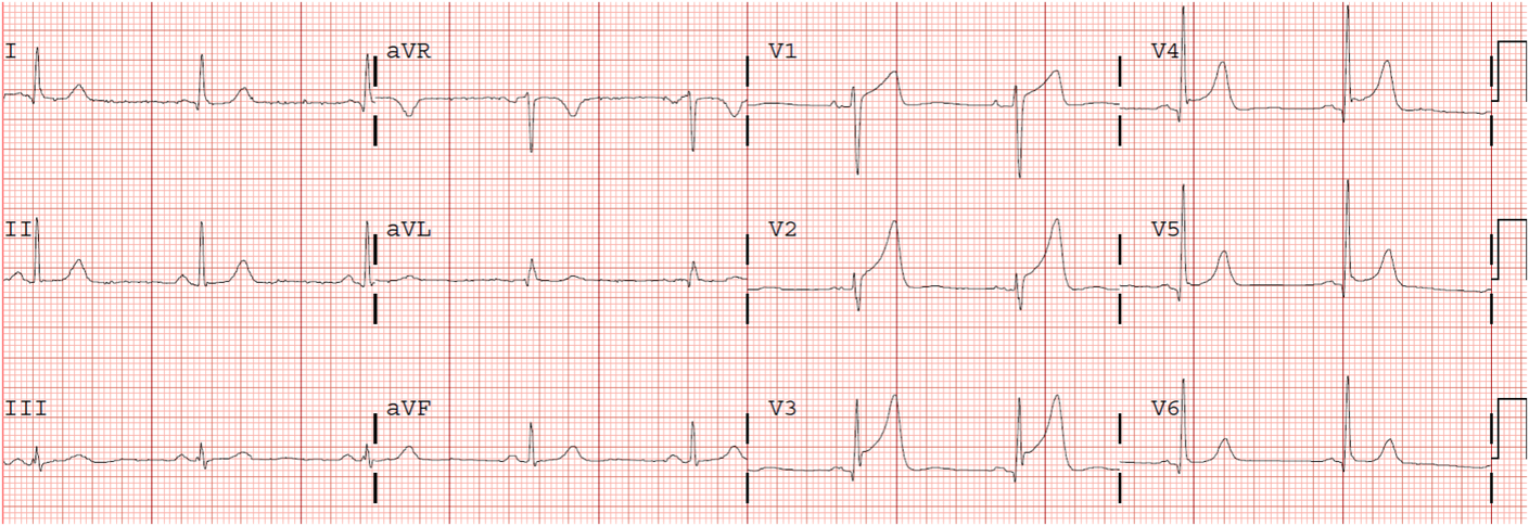 Qrs case study 07 image