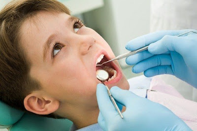 Những trường hợp cần phải niềng răng cho trẻ